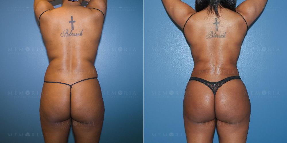 back View