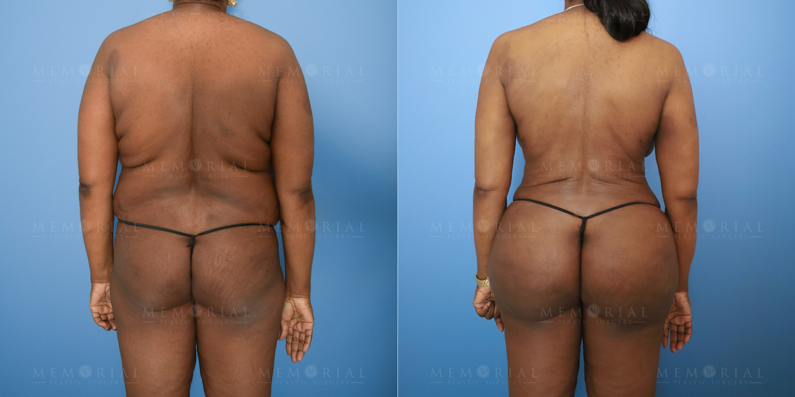 back View