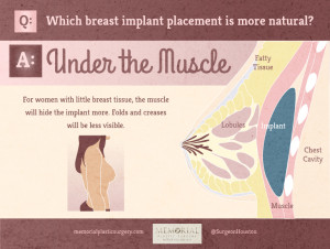 Breast Implant Under The Muscle