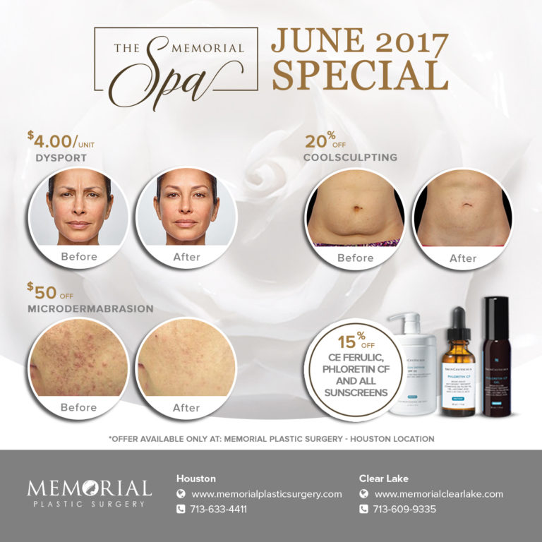 Memorial Spa June 2017 Special