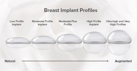 A Quick Look at Breast Implant Profiles - Memorial Plastic Surgery