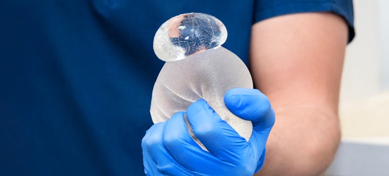 breast implant rupture