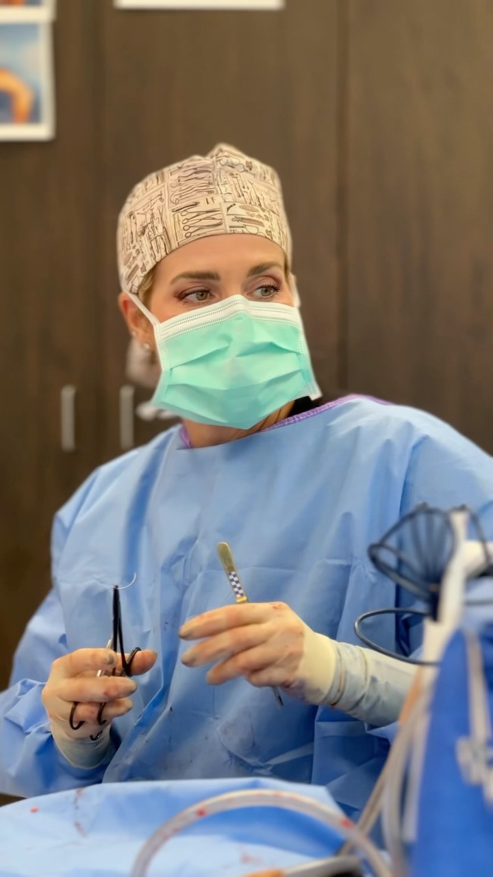 🥵Loving this STUNNING on-table transformation!🔥
It’s just the beginning of her mommy makeover journey and it only gets better from here☺️🤩
Procedure: BBL, Lipo to Flanks, Circumferential Body Lift + Breast Lift w/ Implant Exchange🔥
(Pre-Sx Wt: 144.4lbs Ht: 5’5 BMI 24.0)
#beforeandafter #ontabletransformation #transformation #houstonplasticsurgeon #femaleplasticsurgeon @memorialplasticsurgery