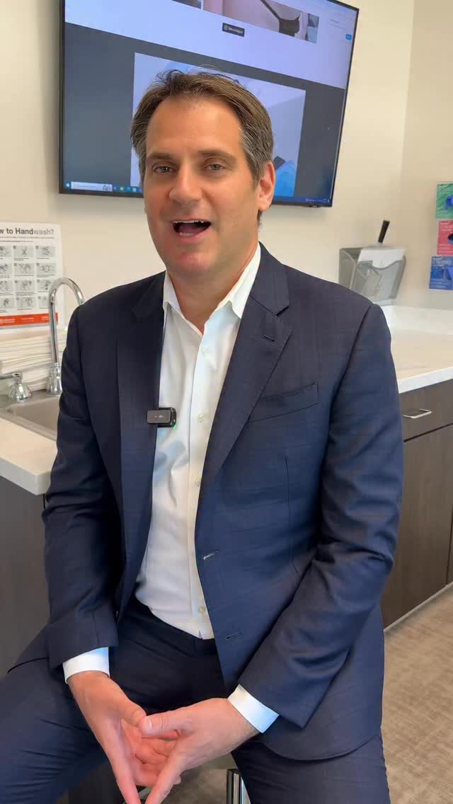 Breast Lift & Implant Exchange at 6 months post-op. 

My beautiful patient wanted to downsize her 415 cc implants, raise the nipples and tighten the breasts that had become droopy over the implants.

The old implants were removed and new 345 cc implants were placed, also a full breast lift (mastopexy) was performed in order to achieve this natural and symmetric long-term result. My patient healed beautifully and I am very happy for her. 🔝😊

Procedure: Breast Lift & Implant Exchange (415cc => 345cc)
(Pre-Sx Wt: 124.6 lbs Ht: 5’5 BMI: 20.7)

#breastsurgery #breastimplants #breastrevision #breastlift #mastopexy #drvasilakis #plasticsurgery @memorialplasticsurgery