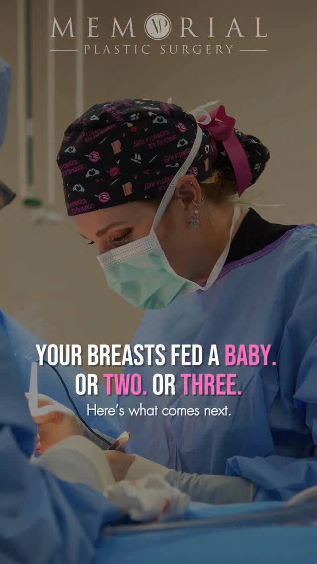 Breastfeeding is one of the most demanding things your body will ever do and breast tissue carries a lot of that weight.
Here’s what’s actually happening 👇🏼
As your milk supply changes, the glandular tissue that once filled out the breast shrinks. But the skin that stretched to accommodate it doesn’t always shrink back. That mismatch is what creates less fullness up top and a nipple position that sits lower than before.
What most women don’t realize is that an implant alone doesn’t fix this. When you add volume under drooping tissue, the implant pulls that same tissue down further over time. That’s one of the most common reasons women end up unhappy with an augmentation that should’ve included a lift.
A breast lift repositions the nipple and reshapes the breast mound using your own tissue first. Once that foundation is corrected, an implant (if you want one) restores volume in a way that actually holds.
This combination is one of the procedures I perform most often on moms, and consistently one of the highest satisfaction surgeries I do. 🤍
📲 Link in bio to book your consult.