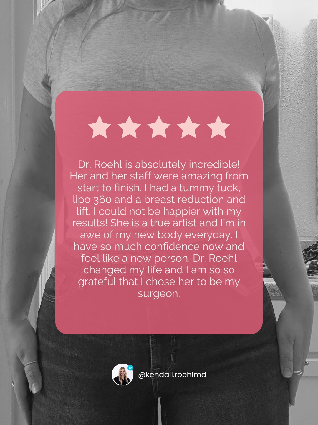 Words like these never get old. 🤍

1.5 years post-op from Tummy Tuck, Lipo360, Breast Reduction & Lift and she’s thriving in her own skin 😍

Swipe to see her results and where she started. So incredibly proud of her! 

📍 @memorialplasticsurgery | #houstontx #mommymakeover