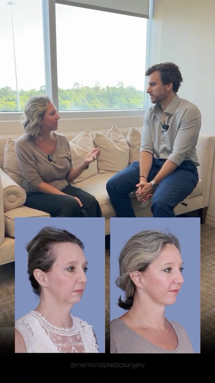 Testimonial Tuesday 🎙️
“I spent a year in the gym doing the hard work. But that’s the one thing I couldn’t fix there.”
6 months later, a new coworker refused to believe she was 47. And when she found out she’d had a facelift? Flabbergasted.
“It truly just looked like me — rewound a little bit.”
That’s the goal. Every single time.
📍 @memorialplasticsurgery | #Houston
Questions below 💬