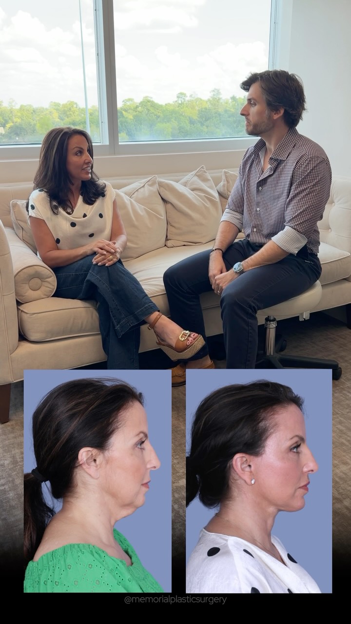 Testimonial Tuesday 🎙️
Unscripted. Unedited.
“My face was aging faster than I felt like I was aging.”
6 months out? She looks in the mirror and sees herself again.
That’s it. That’s the goal. Every single time.
Procedure(s):
🔹Preservation deep plane facelift
🔹Deep neck lift
🔹Temporal brow lift
🔹Chin augmentation
🔹Lip lift
🔹Buccal fat reduction
📍 @memorialplasticsurgery | #Houston #Facelift #Necklift
Questions below 💬
