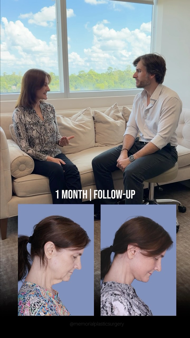 Testimonial Tuesday 🎙️
Unscripted. Unedited.
From “I should look better than this” — to “I can’t pass a mirror without a second look.”
1 month out. 64 years young and feeling more confident than ever. 🤍
Procedures performed:
🔹Preservation deep plane facelift
🔹Deep neck lift
🔹Temporal brow lift
🔹Lower lid blepharoplasty
🔹Facial fat grafting
🔹CO2 laser resurfacing
Questions below 💬
📍 @memorialplasticsurgery | #houstonplasticsurgeon