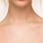How to Get Rid of Neck Wrinkles: Surgical and Non-Surgical Options