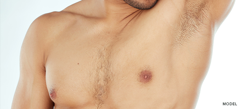 is gynecomastia surgery painful