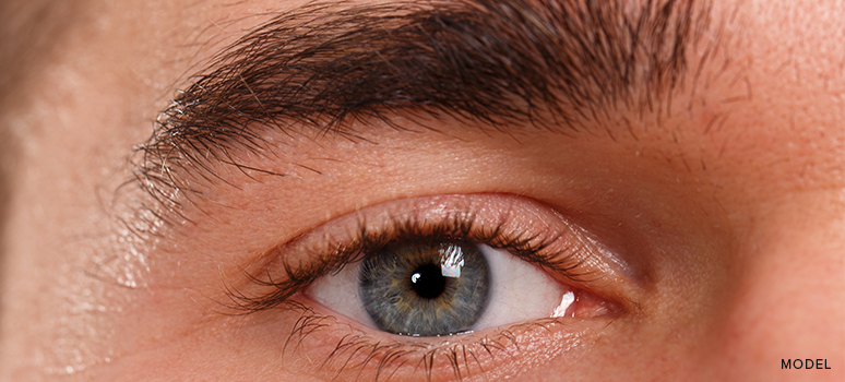 blepharoplasty for men