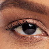 Brow Lift for Droopy Eyelids