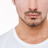 Buccal Fat Removal for Men: Achieving a More Defined and Masculine Look