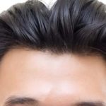 Hair Transplant Results After 10 Years: What to Expect?