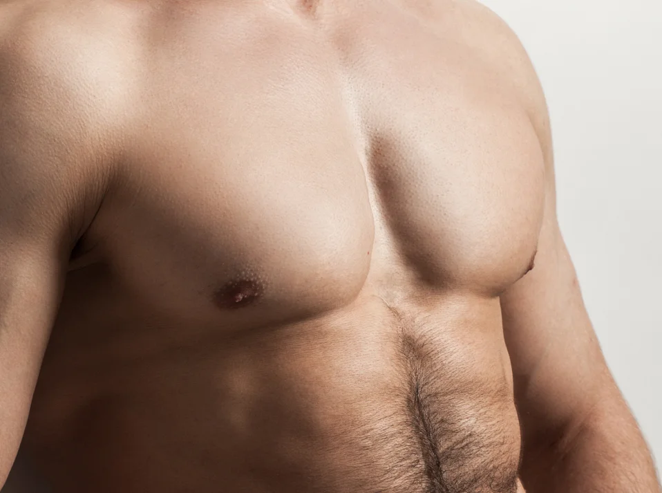 Gynecomastia Featured