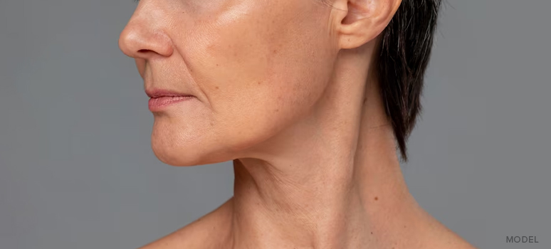 facelift incisions