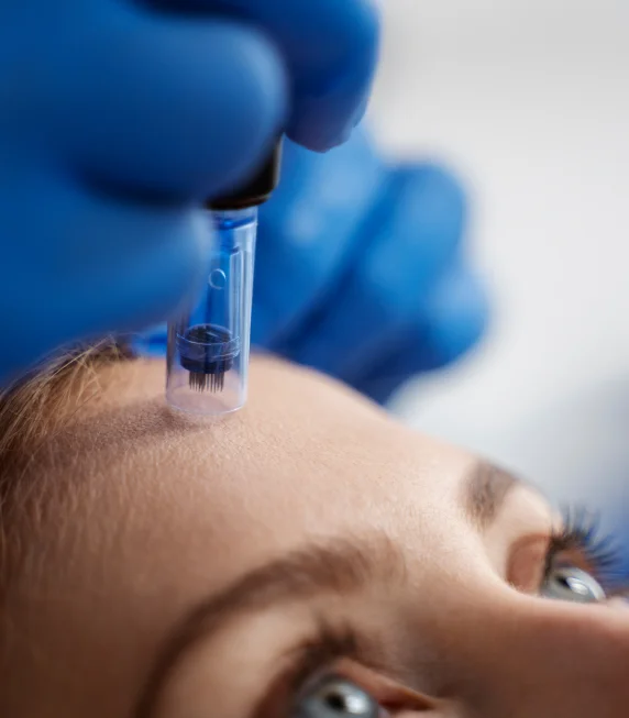 patient undergoing microneedling procedure