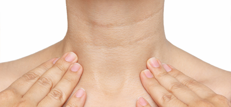 How long does a necklift last