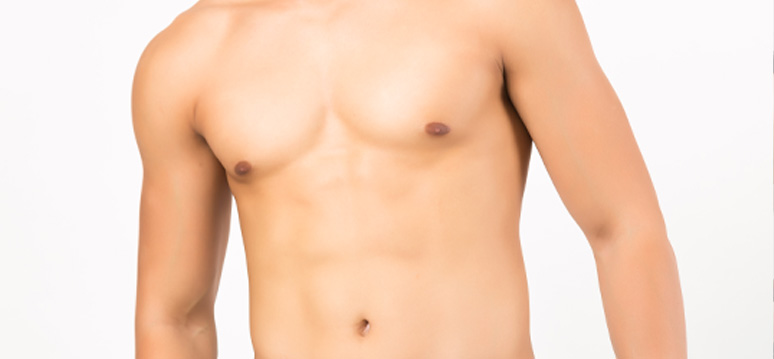 Gynecomastia Causes