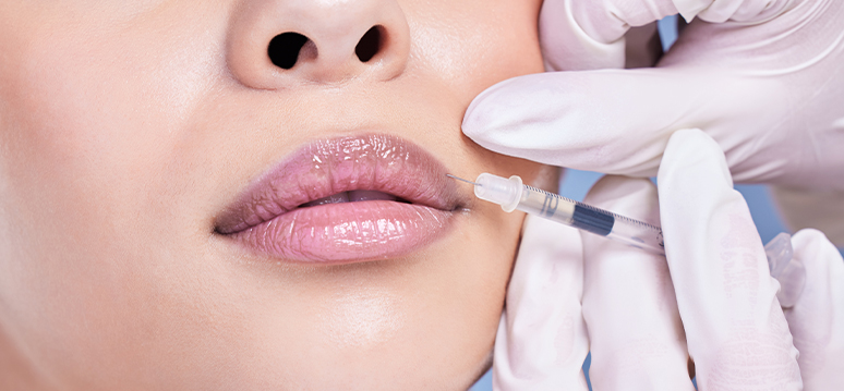 Lip Augmentation Procedure - Memorial Plastic Surgery - Houston, Texas